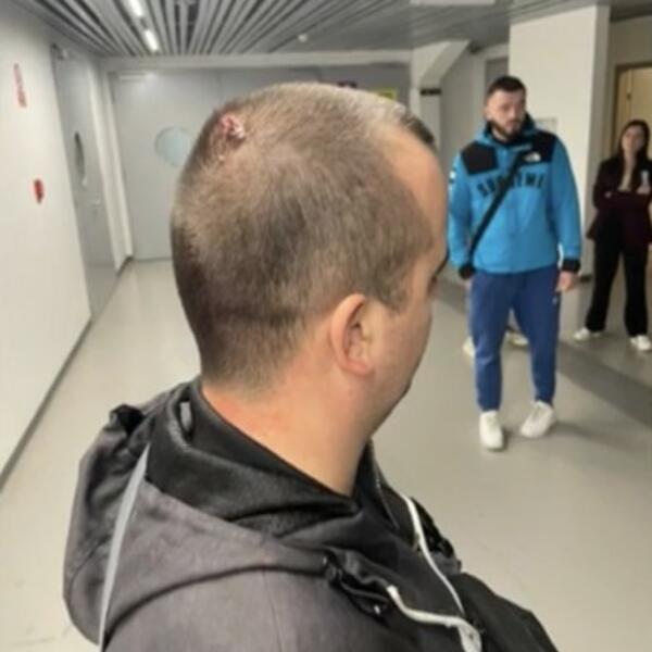 objavljene fotografije napadnutih novinara: ovo su srbi koji su pretučeni u zadru pred utakmicu crvene zvezde (foto)