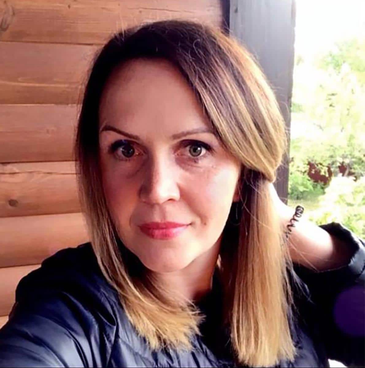 ANA UMRLA POSLE OPERACIJE! Otišla na plastičnu intervenciju, bila u rukama vrhunskog hirurga – A onda je sve POŠLO PO ZLU: Evo šta je uzrok smrti