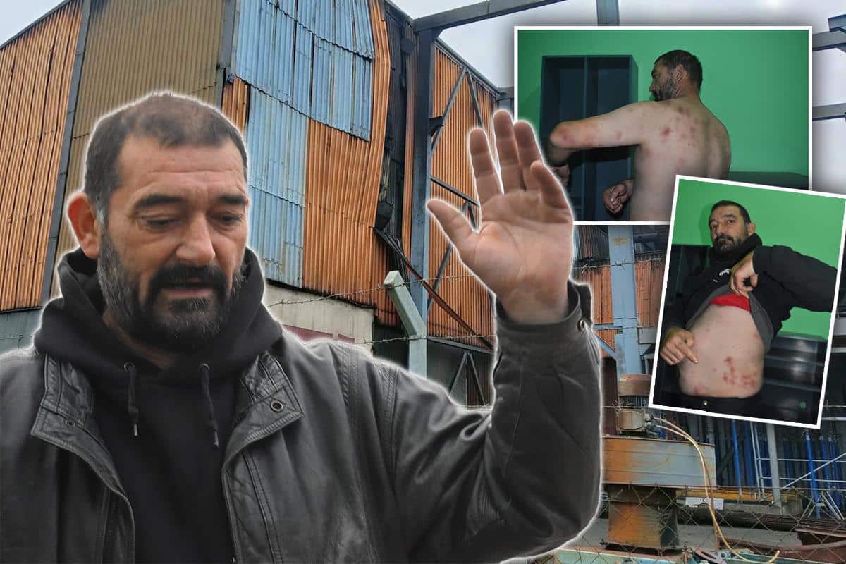 “ODJEDNOM JE PUKLO, VIDEO SAM KOLEGE NA ZEMLJI, BILI SU POTPUNO UGLJENISANI” Ispovest povređenog radnika u Čoki, do detalja opisao stravu i užas u livnici VIDEO