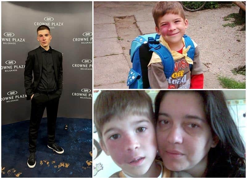 Zvali su me Flekavi, govorili da je odvratno i da to skinem: Nikola (24) je dugo trpeo maltretiranje vršnjaka ali odlučio da ipak ne ukloni beleg s lica (Foto)