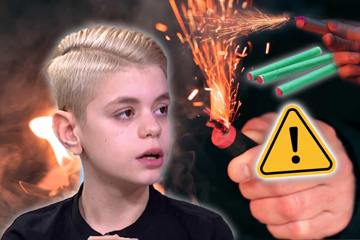 “DELOVI DVA PRSTA SU OTPALI, BILI SU SAGORENI” Bolna ispovest Konstantina kome je petarda raznela deo šake: Nepoznat čovek je došao i ponudio nam jake petarde!