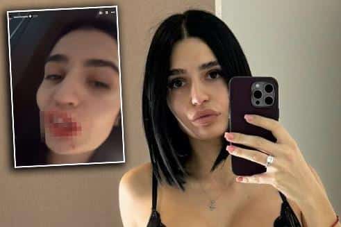 TAMARA BOJANIĆ PRETUČENA! Starleta sva KRVAVA I UPLAKALA, isplivao jeziv snimak! Optužila DEČKA da ju je NAPAO, a razlog je više nego ŠOKANTAN
