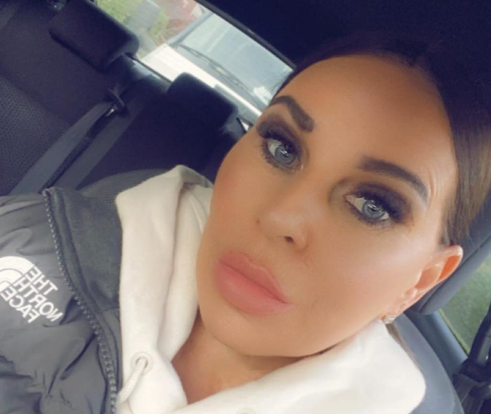 “Izgledam kao da imam crve u obrazima” Natalija zakazala estetski zahvat preko Instagrama, pa prošla pakao, a onda je pala u šake turskog plastičara FOTO