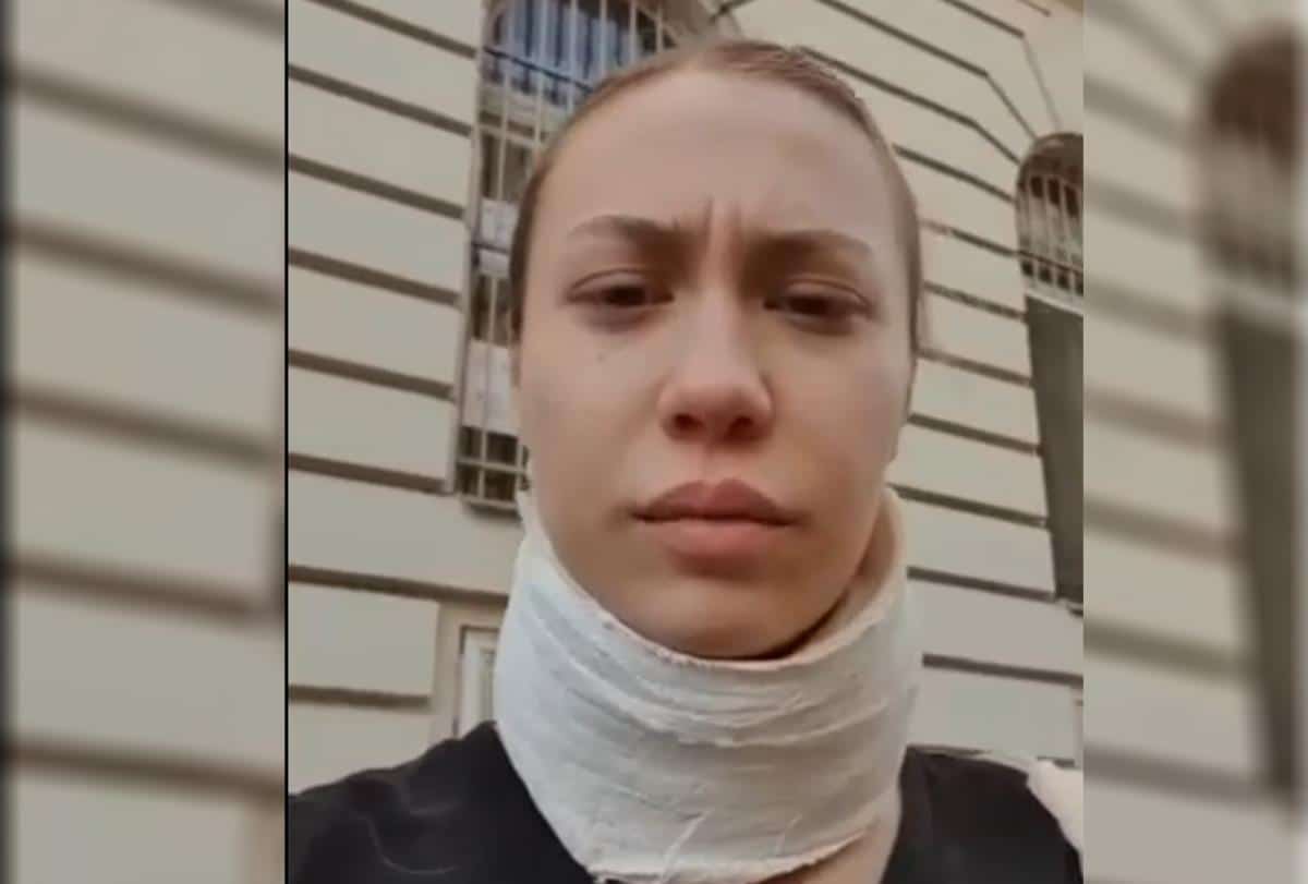 OVA POVREDA KOJU VIDITE NA MENI POSLEDICA JE NASILNOG PONAŠANJA MOJE PROFESORKE Pogledajte pakao kroz koji je prošla devojka jer joj je zabranjen ulazak u školu