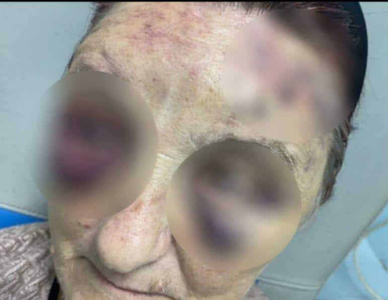 MIRSADA JE ZBOG BATINA SUPRUGA DVA MESECA BILA U BOLNICI: Imala je balone krvi oko očiju, a sada se oglasilo tužilaštvo! Evo šta će biti sa MONSTRUMOM