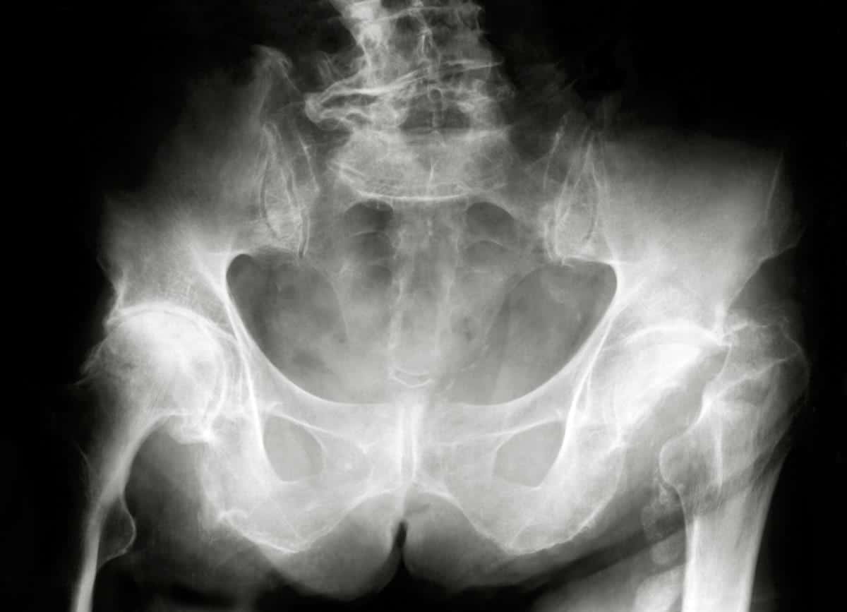 Zaigrao se vibratorom, pa molio lekare za pomoć: Zujanje nije prestajalo, a onda su lekari izvukli čudo od 20 centimetara