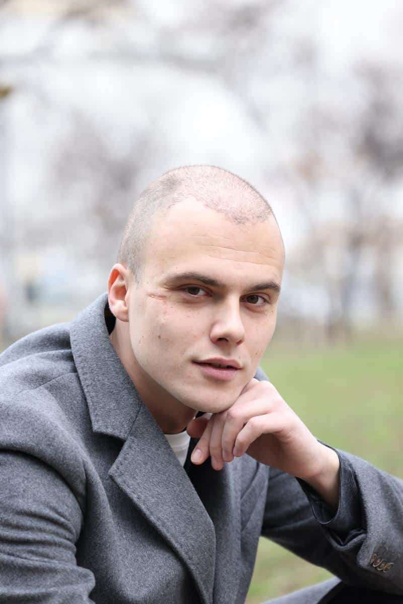 Ovo je prava istina o ožiljku na licu Miše Dragičevića: Danas je njegov zaštitni znak, a evo kako ga je dobio