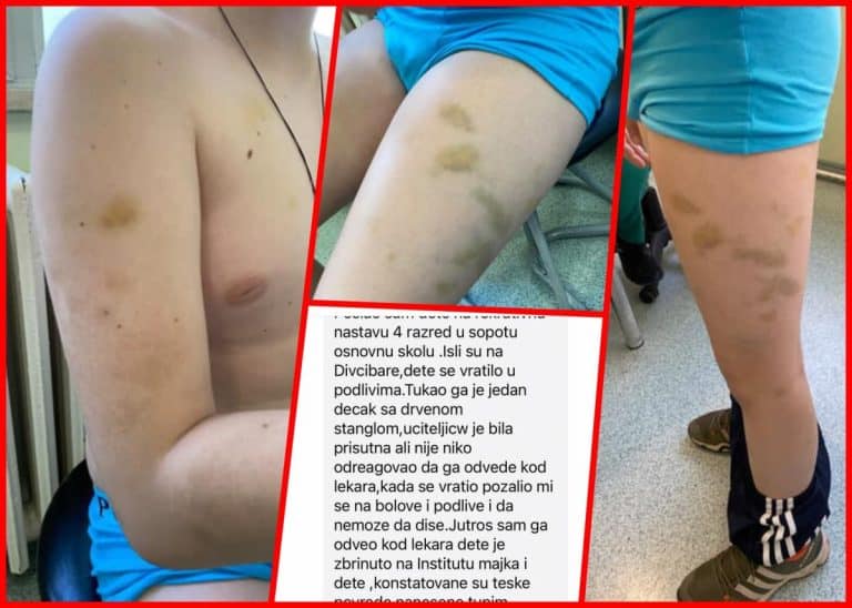 Drama na Divčibarama! Vršnjak pretukao dečaka motkom na rekreativnoj nastavi! Dok ga je mlatio dete kukalo: Oglasila se škola