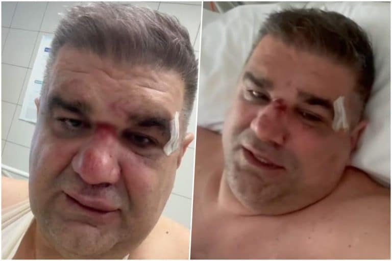 SAŠA MIRKOVIĆ OPERISAN! Oglasio se nakon buđenja iz anestezije i otkrio detalje prebijanja: Dobio sam udarac u potiljak, a onda je krenulo muško šutiranje..
