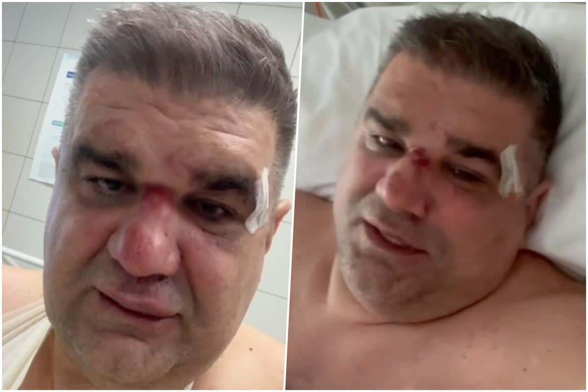 SAŠA MIRKOVIĆ OPERISAN! Oglasio se nakon buđenja iz anestezije i otkrio detalje prebijanja: Dobio sam udarac u potiljak, a onda je krenulo muško šutiranje..