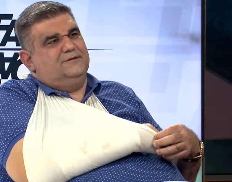 DOK ME JE ŠUTIRAO GOVORIO MI JE “NE DIRAJ VIŠE CECU I PEJOVIĆA!” Prvo Mirkovićevo pojavljivanje u javnosti nakon napada: “Prošao sam golgotu zbog DŽEPAROŠA